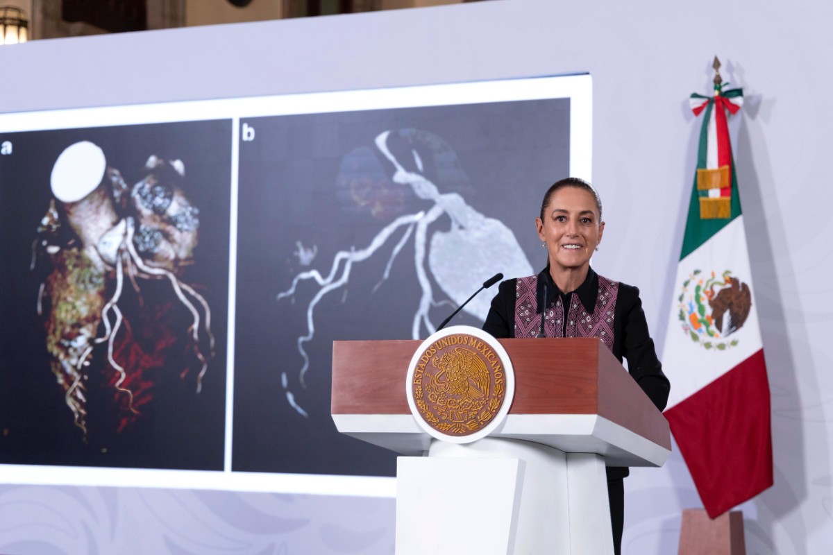 GOBIERNO DE CLAUDIA SHEINBAUM REFUERZA AL IMSS, ISSSTE E IMSS-BIENESTAR CON EQUIPAMIENTO DE ALTA TECNOLOGÍA Y TELEMEDICINA